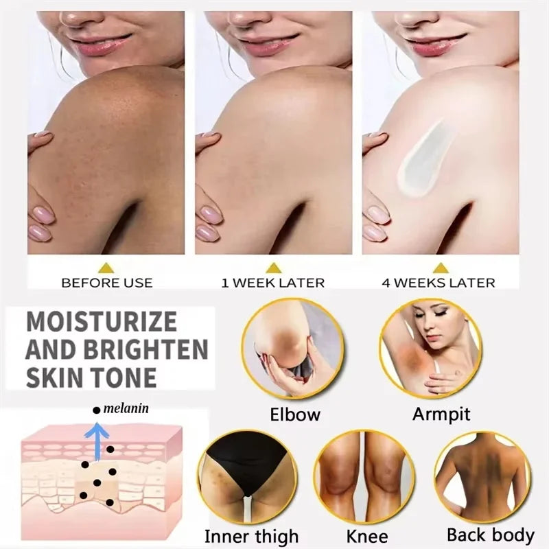 Whitening Cream Private Parts Underarm Bleaching Lotion Whiten Butt Knee Brighten Inner Thigh Intimate Parts Dark Remove Melanin