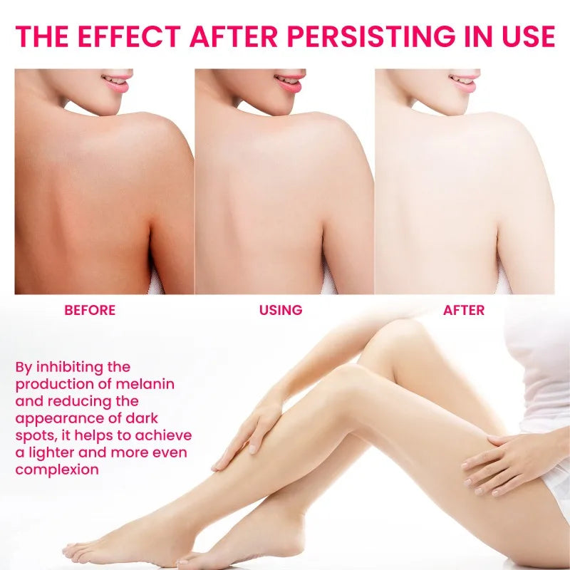 Inner Thigh Brightening Cream Private Parts Lighten Cream Intimate Area Armpit Knee Bleach Emulsion Underarm Brighten Skin Care