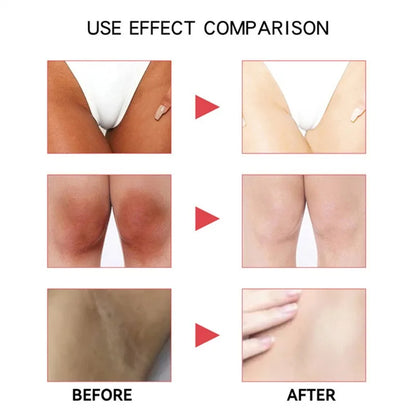 Inner Thigh Brightening Cream Private Parts Lighten Cream Intimate Area Armpit Knee Bleach Emulsion Underarm Brighten Skin Care