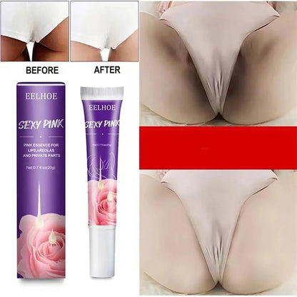 Remove Dark Melanin Whitening Cream Private Parts Underarm Bleaching Serum Whiten Butt Knee Brighten Inner Thigh Intimate Parts