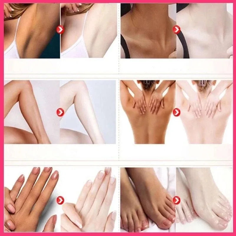 Remove Dark Melanin Whitening Cream Private Parts Underarm Bleaching Serum Whiten Butt Knee Brighten Inner Thigh Intimate Parts