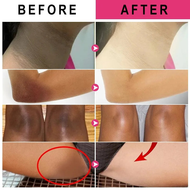 Inner Thigh Brightening Cream Private Parts Lighten Cream Intimate Area Armpit Knee Bleach Emulsion Underarm Brighten Skin Care